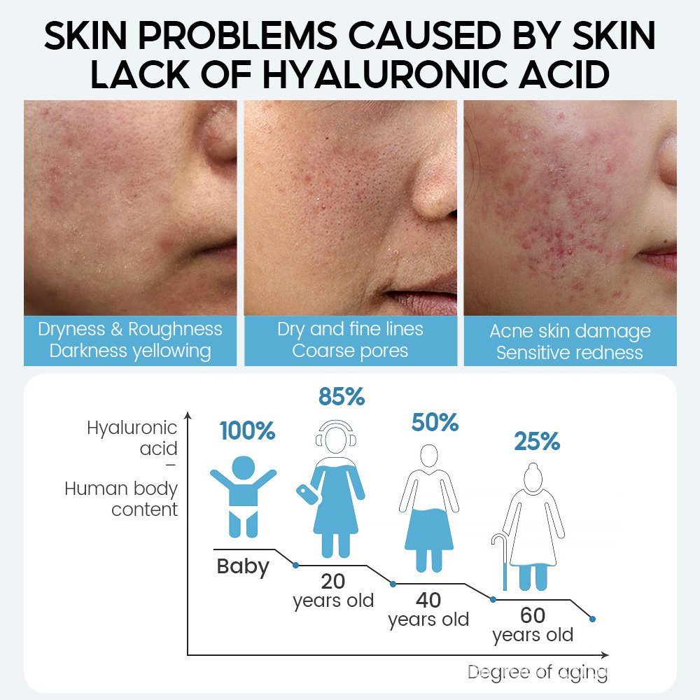 Hyaluronic Acid Face Serum & Anti-Aging Moisturizing Cream for Dry Skin - Image 6