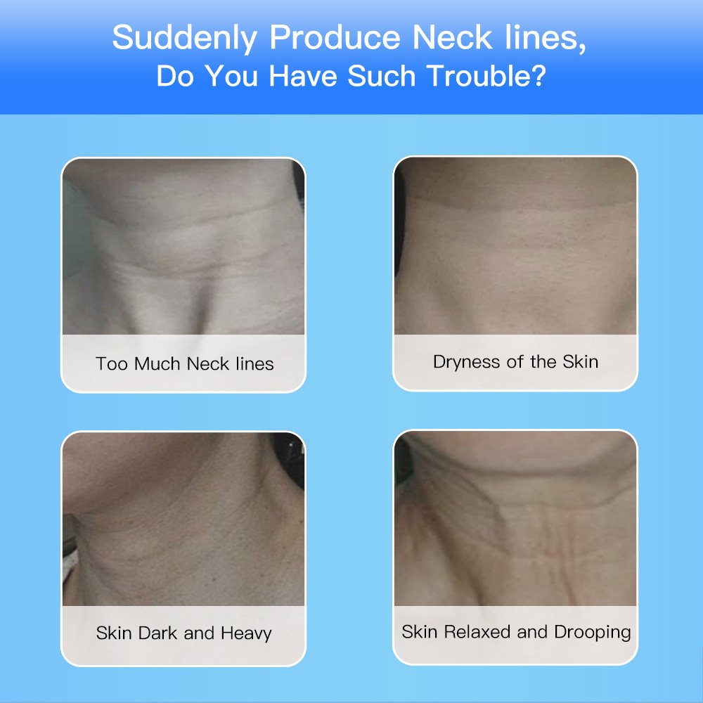 EMS Microcurrent Neck & Face Lifting Device | 3-Color LED Photon Therapy - Image 6